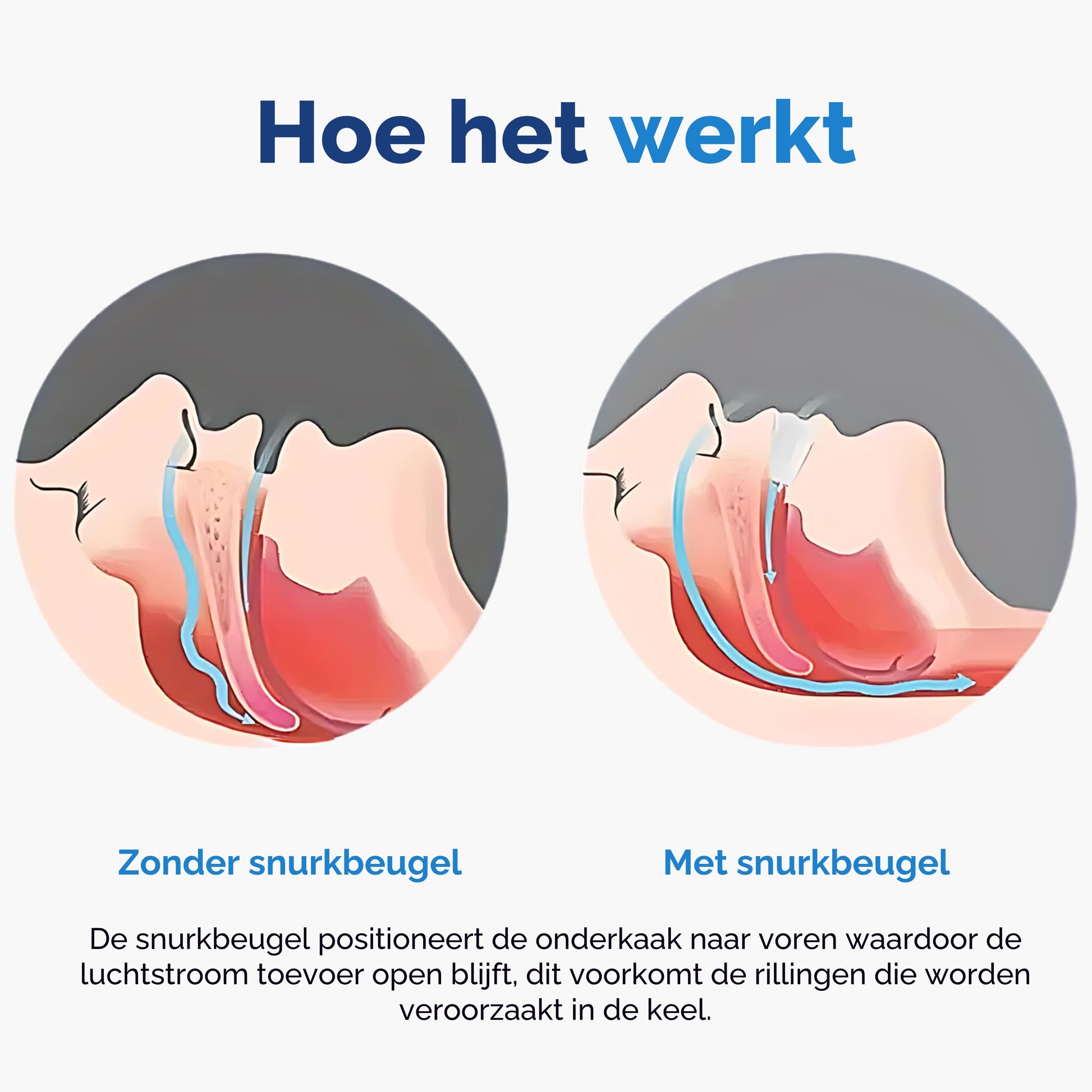Snurkbeugel & Oordopjes Bundel
